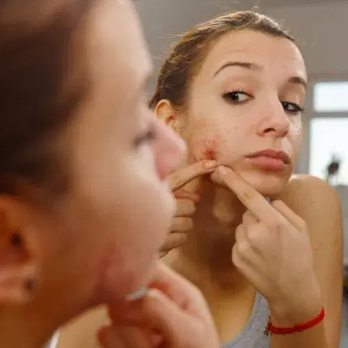 Macchie
