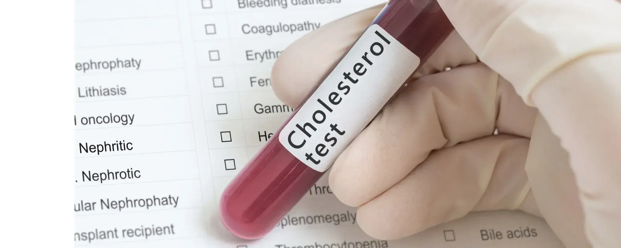 Dislipidemia