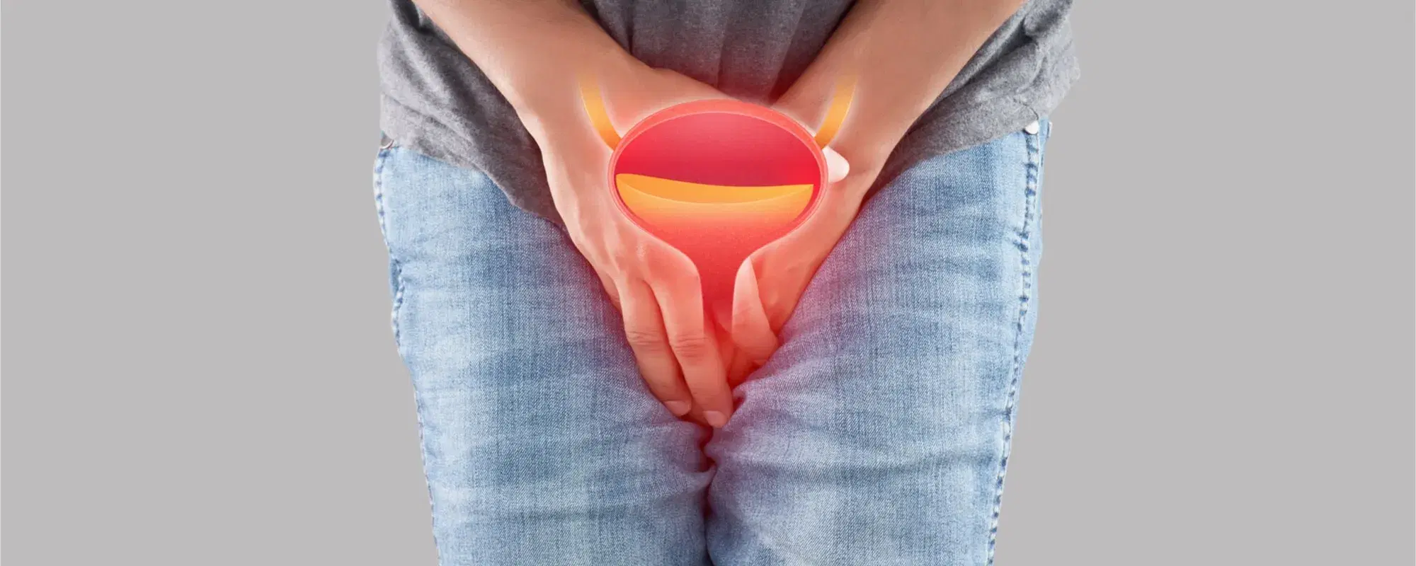 Uretrite